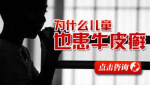 牛皮癣常见的病因是什么